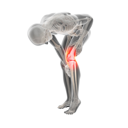 Knee Arthroscopy 1
